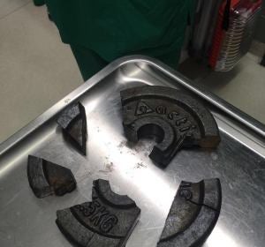 Restos del disco de pesos donde quedó atrapado el pene de un hombre Restos del disco de pesos donde quedó atrapado el pene de un hombre