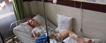 Amarna Miller tiene un accidente de moto en Filipinas
