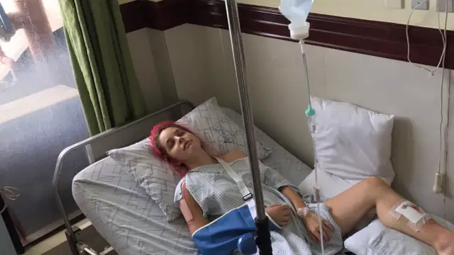 Amarna Miller tiene un accidente de moto en Filipinas