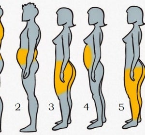 Los seis tipos de obesidad que existen Los seis tipos de obesidad que existen