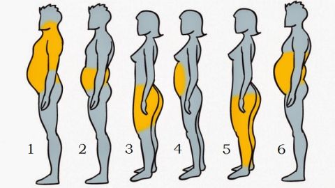 Los seis tipos de obesidad que existen