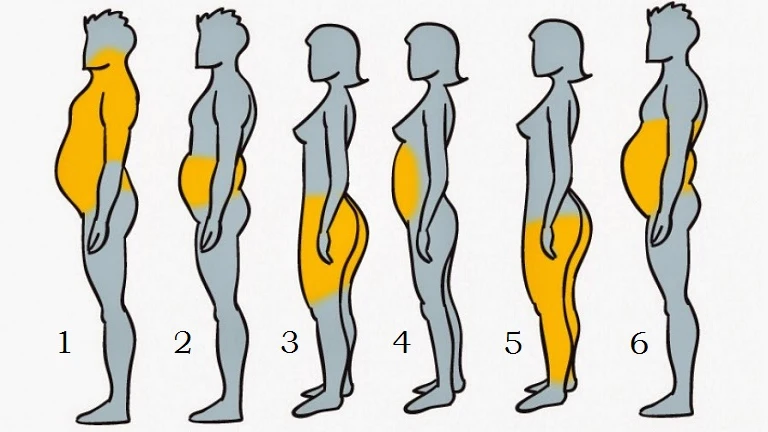 Los seis tipos de obesidad que existen
