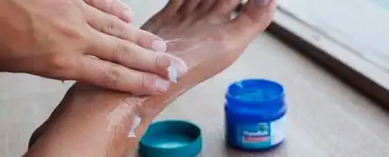 Vicks VapoRubs para curar la piel agrietada Vicks VapoRubs para curar la piel agrietada