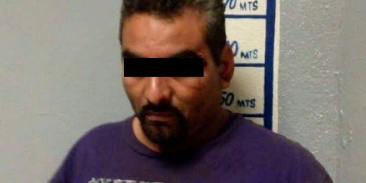 Le arranca la nariz a su hermano de un mordisco
