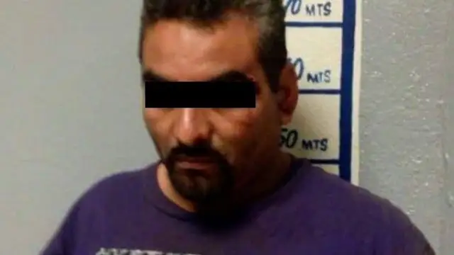 Le arranca la nariz a su hermano de un mordisco
