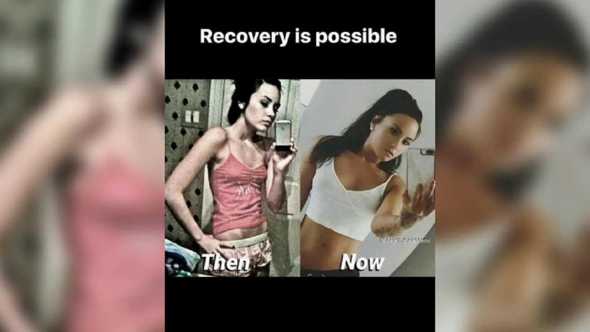 Demi Lovato comparte una foto de su lucha contra la bulimia