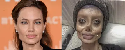 Se opera más de 50 veces para parecerse a Angelina Jolie Se opera más de 50 veces para parecerse a Angelina Jolie