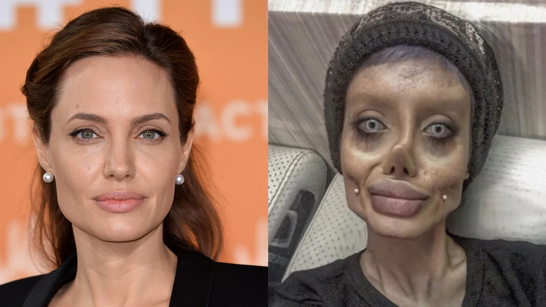 Se opera m&aacute;s de 50 veces para parecerse a Angelina Jolie