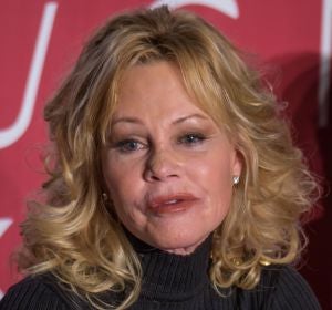 Algo le ha pasado en la cara a Melanie Griffith Algo le ha pasado en la cara a Melanie Griffith