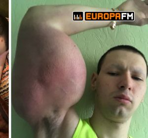 El 'popeye ruso' no aguanta más el dolor El 'popeye ruso' no aguanta más el dolor
