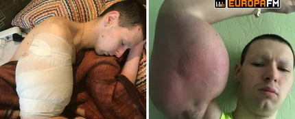 El 'popeye ruso' no aguanta más el dolor El 'popeye ruso' no aguanta más el dolor