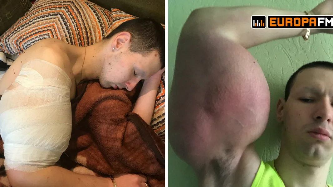 El 'popeye ruso' no aguanta más el dolor en tu mano está ponerlo en práctica o no