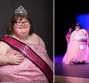 Una adolescente con una extraña patología y 172 kilos de peso gana un concurso de belleza en EEUU Una adolescente con una extraña patología y 172 kilos de peso gana un concurso de belleza en EEUU