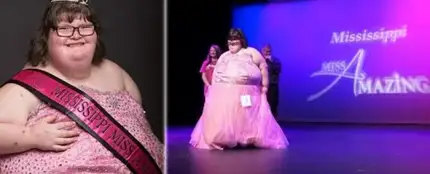 Una adolescente con una extraña patología y 172 kilos de peso gana un concurso de belleza en EEUU Una adolescente con una extraña patología y 172 kilos de peso gana un concurso de belleza en EEUU