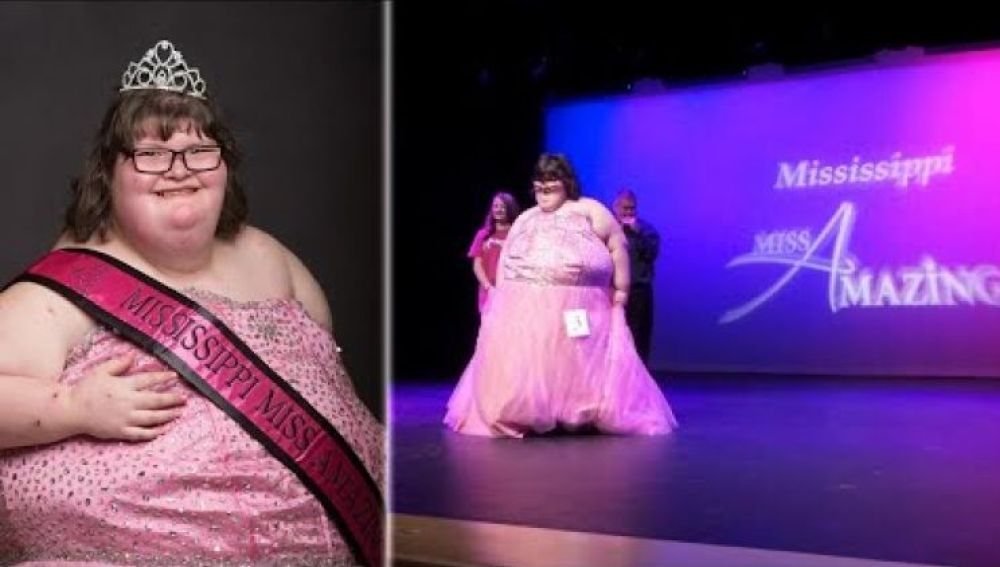 Una adolescente con una extraña patología y 172 kilos de peso gana un concurso de belleza en EEUU