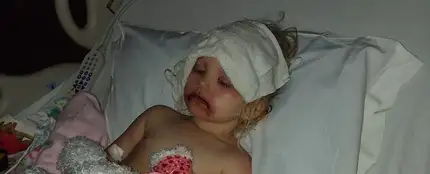 La pequeña Lydia, hospitalizada tras una reacción alérgica al maquillaje infantil La pequeña Lydia, hospitalizada tras una reacción alérgica al maquillaje infantil