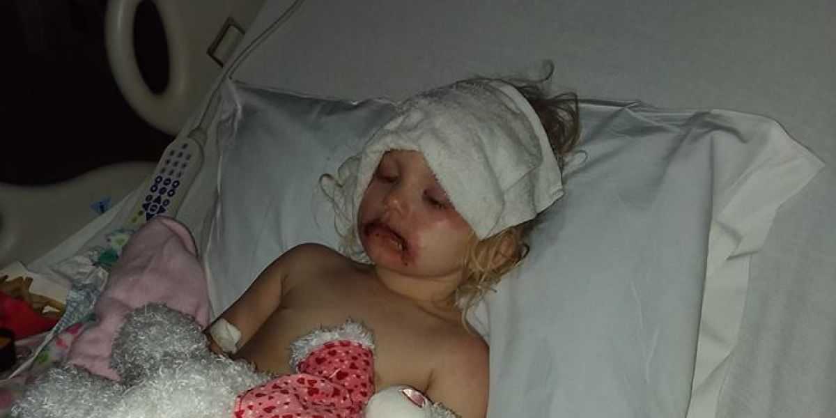 La pequeña Lydia, hospitalizada tras una reacción alérgica al maquillaje infantil