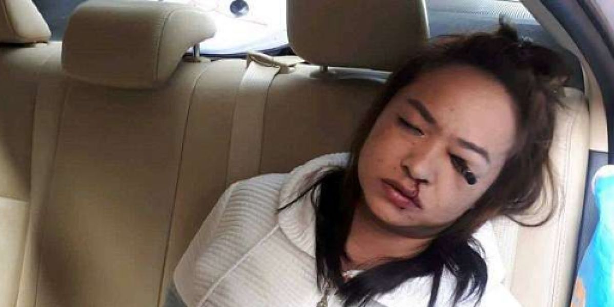Se clava un lápiz en el ojo por maquillarse dentro de un taxi en marcha