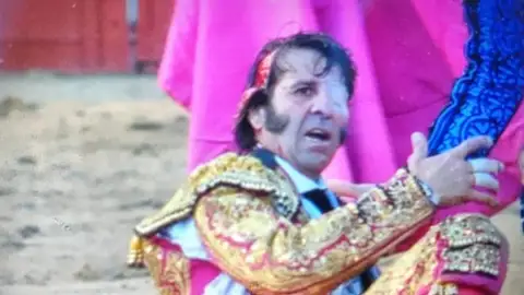 Juan José Padilla, con una parte del cuero cabelludo desprendida Juan José Padilla, con una parte del cuero cabelludo desprendida