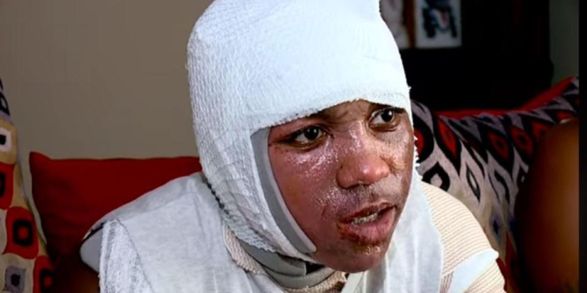 Kyland Clark, joven afectado por el 'Hot Water Challenge'