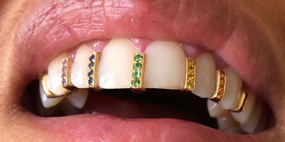 Adornos en los dientes