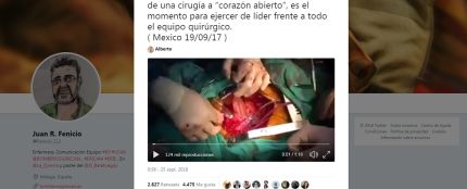 Un terremoto sorprende a un cirujano mientras opera a corazón abierto