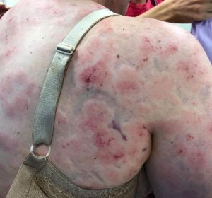La heridas que sufrió la mujer La heridas que sufrió la mujer