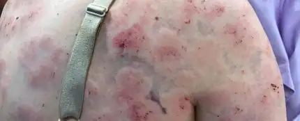 La heridas que sufrió la mujer La heridas que sufrió la mujer
