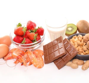 Alimentos que generan alergias Alimentos que generan alergias