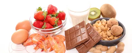 Alimentos Alimentos
