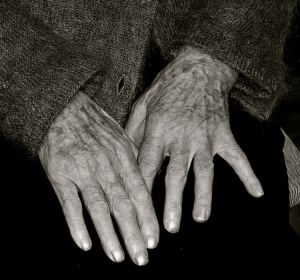 Manos de una anciana Manos de una anciana