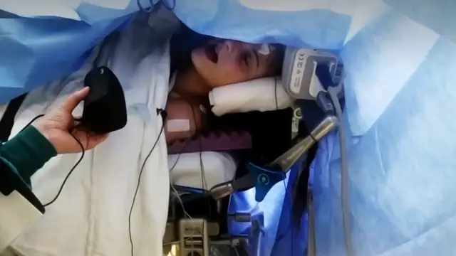 Una chica de 19 años canta mientras le extirpan un tumor cerebral