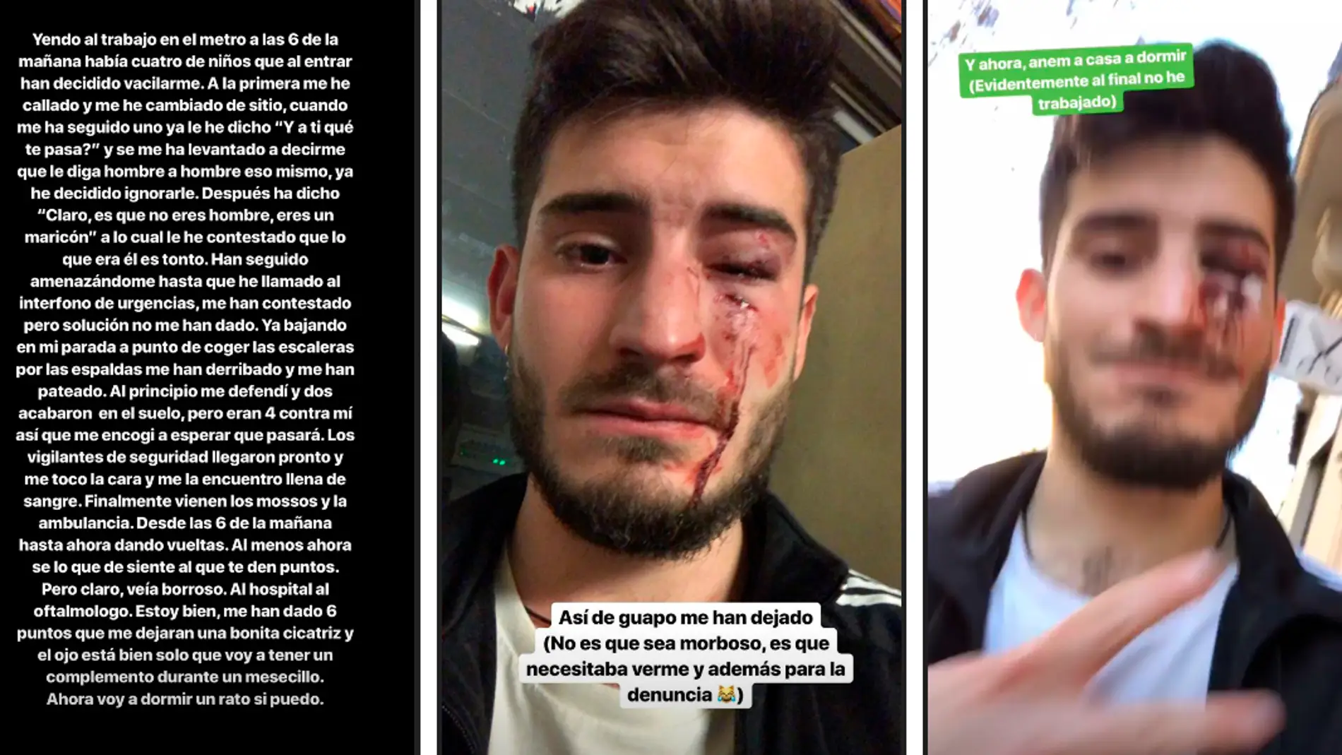 La víctima de la agresión homófoba en el metro de Barcelona denuncia los hechos en las redes sociales title=