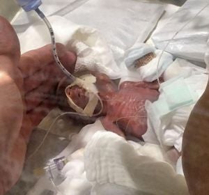Imagen del bebé tras nacer Imagen del bebé tras nacer