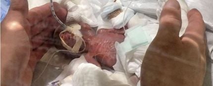 Imagen del bebé tras nacer