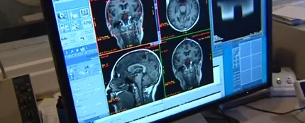 El cerebro humano genera nuevas neuronas hasta los 90 años El cerebro humano genera nuevas neuronas hasta los 90 años