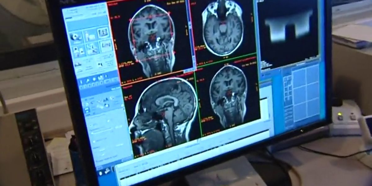 El cerebro humano genera nuevas neuronas hasta los 90 años