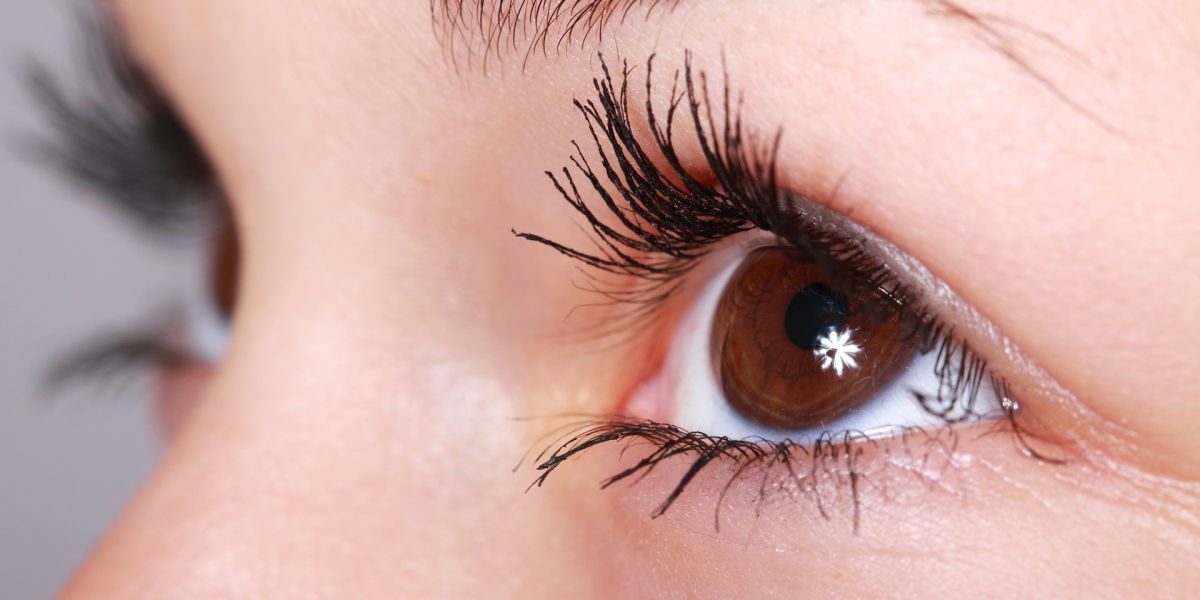 Ojos