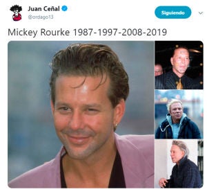Mickey Rourke vuelve a operarse y las redes estallan Mickey Rourke vuelve a operarse y las redes estallan