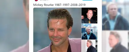 Mickey Rourke vuelve a operarse y las redes estallan Mickey Rourke vuelve a operarse y las redes estallan