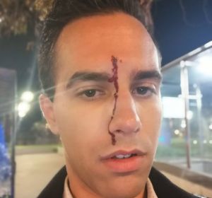 El periodista Xavier Martínez tras sufrir una agresión homófoba El periodista Xavier Martínez tras sufrir una agresión homófoba