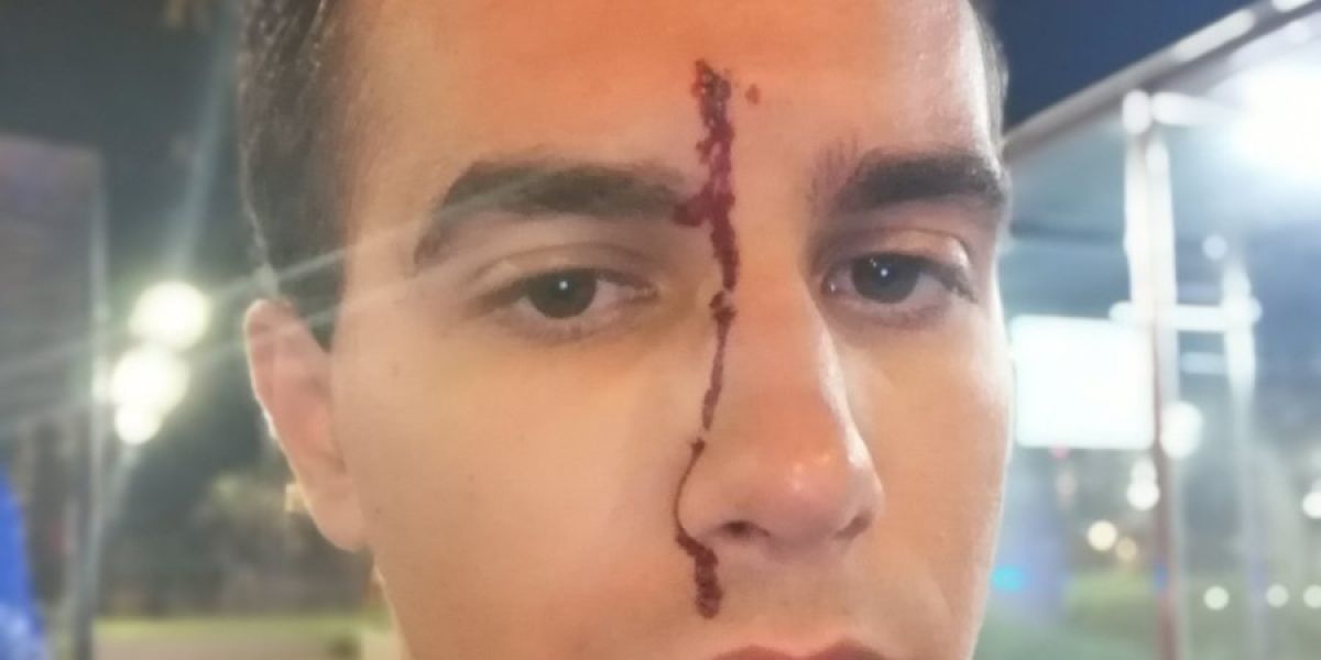 El periodista Xavier Martínez tras sufrir una agresión homófoba