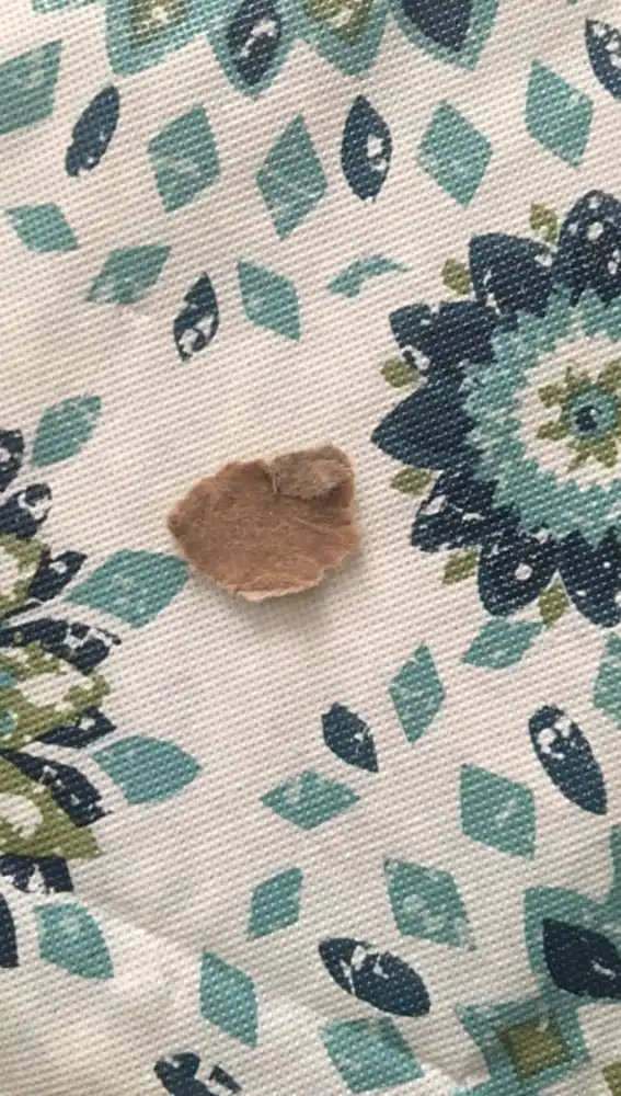 El cartón que tenía la pequeña en el paladar El cartón que tenía la pequeña en el paladar