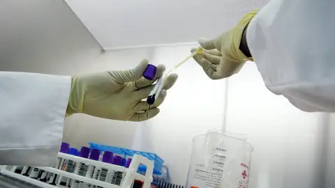 Análisis de sangre Análisis de sangre