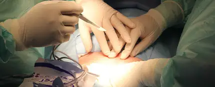 Cirujanos realizando una operación Cirujanos realizando una operación