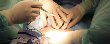 Cirujanos realizando una operación Cirujanos realizando una operación