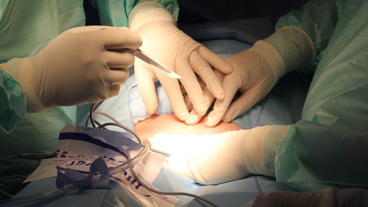Cirujanos realizando una operación Cirujanos realizando una operación