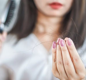 Caída del cabello Caída del cabello