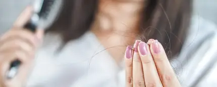 Caída del cabello Caída del cabello