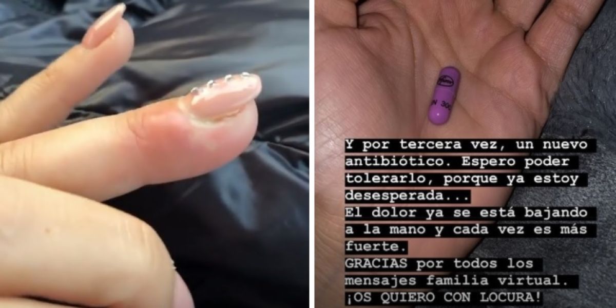 El dedo de Tamara Gorro
